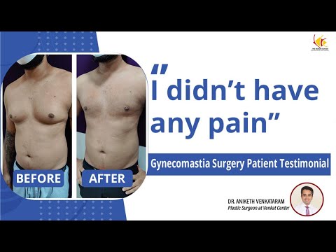 Gynecomastia Surgery Experience | Man Boobs Reduction Surgery | Venkat Center