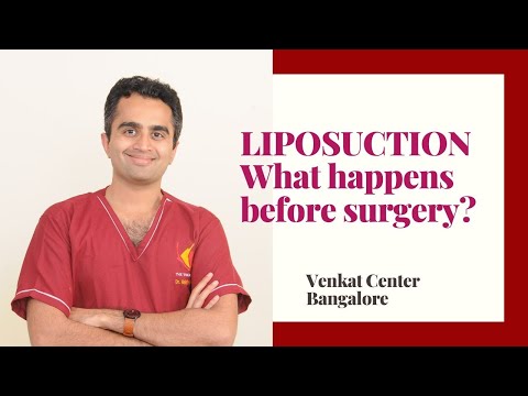 Liposuction- What happens before surgery? (how to prepare). Venkat Center Bangalore