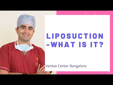 Liposuction- what is it? (can it reduce my weight?) Venkat Center Bangalore