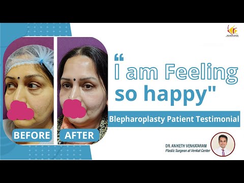 Eyelid Surgery Reviews | Blepharoplasty Surgery in India | Venkat Center