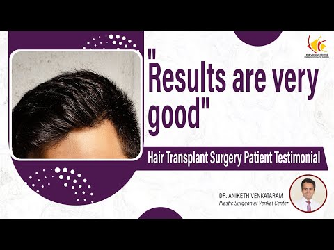 Hair Transplant Result | Hair Transplant in India | Venkat Center Bangalore