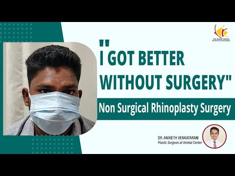 Non surgical Rhinoplasty in India | Patient's Feedback on Nose Job without Surgery | Venkat Center