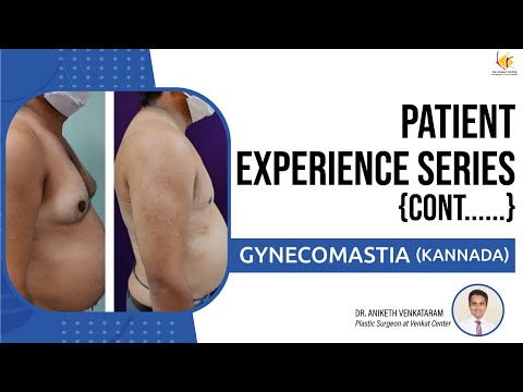 Patient Experience Series: Gynecomastia (Kannada)