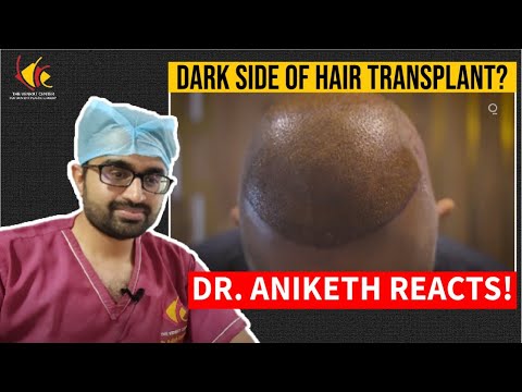 React Videos: Istanbul as a place for Hair transplantation | Crucial facts revealed