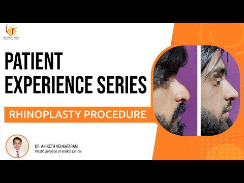 Nose Job Reviews: Rhinoplasty Patient Sharing His Experience - Shekar Eye Hospital