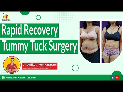 Rapid Recovery from Abdominoplasty (tummy tuck)- is it possible? Dr. Aniketh Venkataram explains