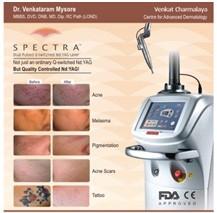 Fractional laser treatment for melasma