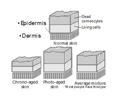 ageing factor