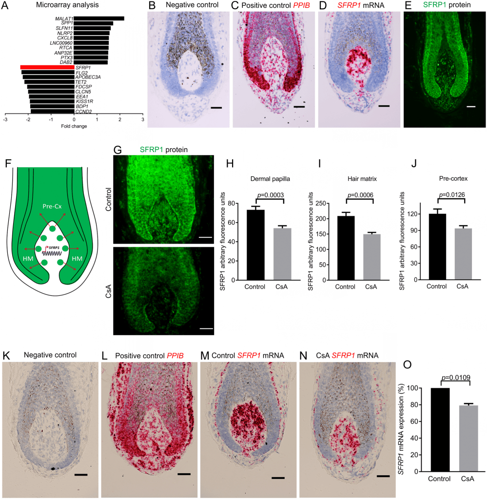 CsA treatment for hair loss down-regulates SFRP1 in the DP of human HFs ex vivo.