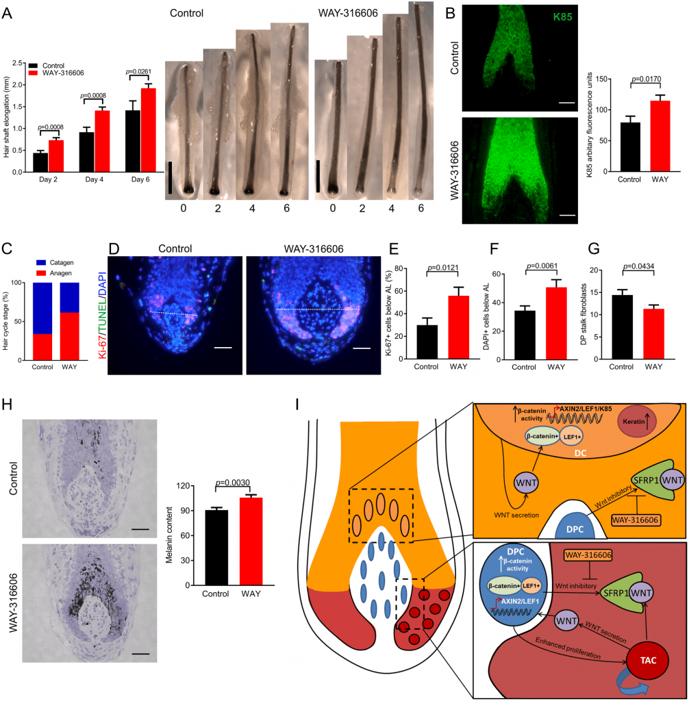 Inhibiting SFRP1 activity with WAY-316606 enhances human hair growth, increases K85 protein expression, and inhibits spontaneous catagen ex vivo.