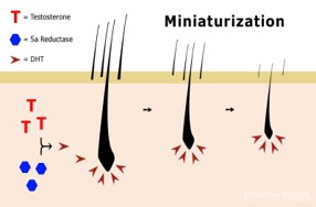 Miniaturization of Hair Representation
