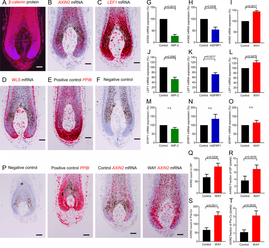 SFRP1 modulates canonical β-catenin activity at the ligand level in the human hair follicle bulb ex vivo.