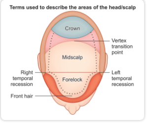 special areas in hair transplant | Scalp