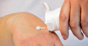 topical steroids damaged skin