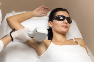 Best Laser hair removal in Bangalore