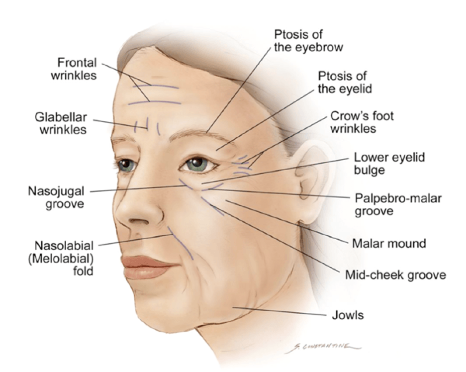 signs of ageing