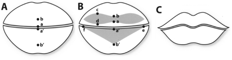 Lip Reduction Procedure