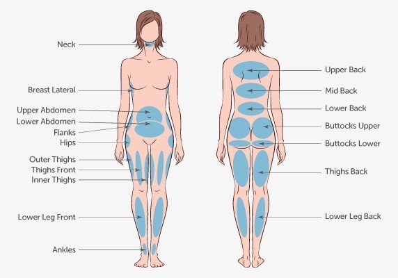 Liposuction in Women