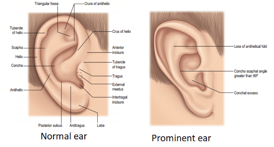 ear surgery cost