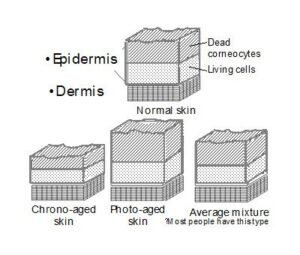 Different skin thickness by type of ageing