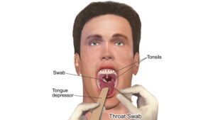 Tonsillitis treatment at Venkat Center, Bangalore