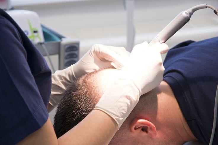 Body Hair Transplantation in Bangalore, India 2 Body Hair Transplantation in Bangalore, India 1
