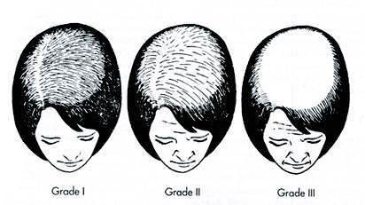 Hairfall types