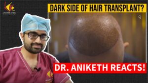 Dr. Aniketh reacts to Dark Side of Hair Transplant