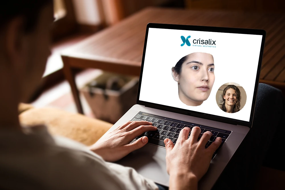 Crisalix 3D face - at Venkat Center, Bangalore