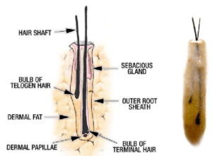 Introduction to Hair Transplant 1
