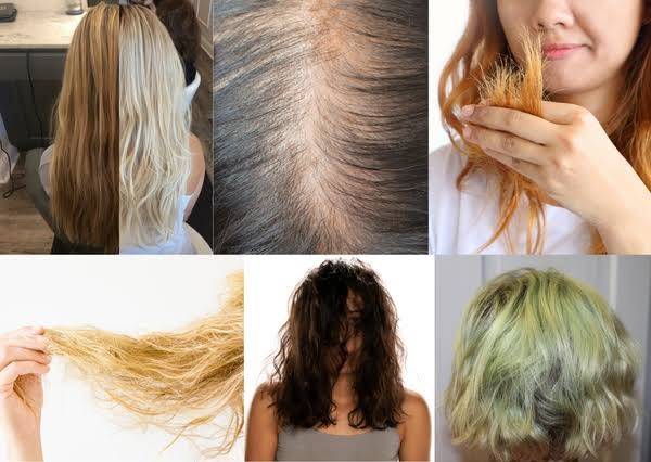 How to treat hair-fall caused by hard water? 1 How to treat hair-fall