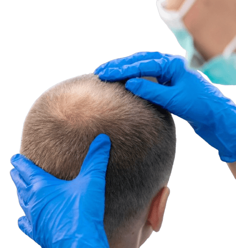 Leading Hair, Skin & Plastic Surgery Clinic In Bangalore, India - The Venkat Center 6
