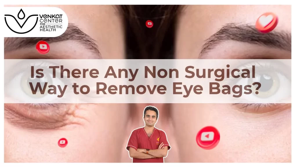 Non-Surgical Methods For Eyebags | Dr. Aniketh Venkataram 1