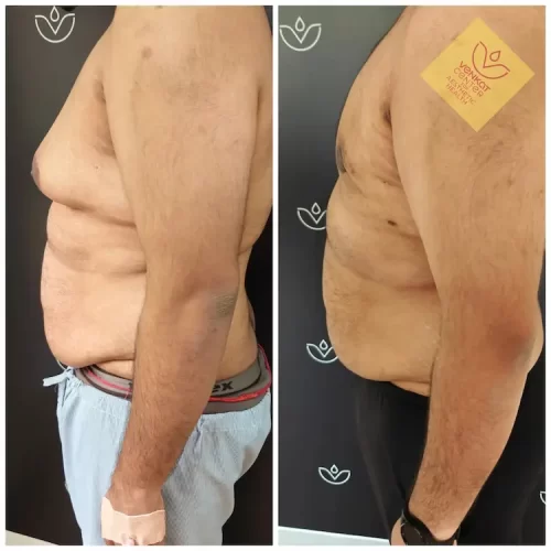 Picsart_25-08-23_11-50-34-530